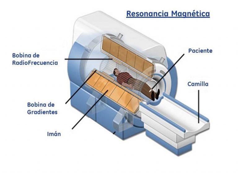 ¿Cómo funciona la Resonancia Magnética? Te lo explicamos de forma